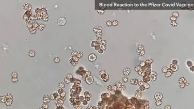 Watch COVID Shot Juice Attack Human Blood In Real Time