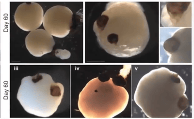 Human Brain Neuron Organoids