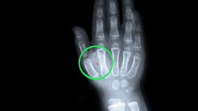 New Viral Video About Vaccine Passport Implants Revives Fears of Chipping Humans