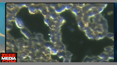 nanobots-inside-people-are-programming-humanity-mindcontrol - Watch